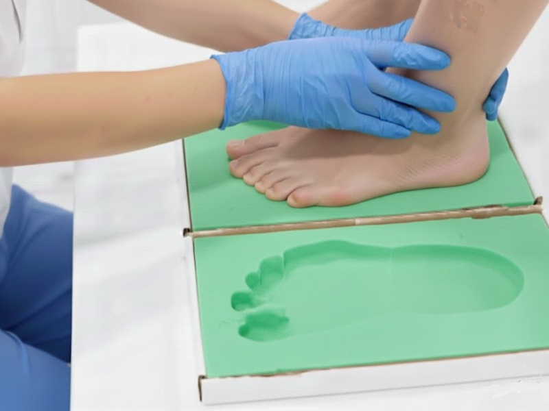 Calco del piede plantare su misura